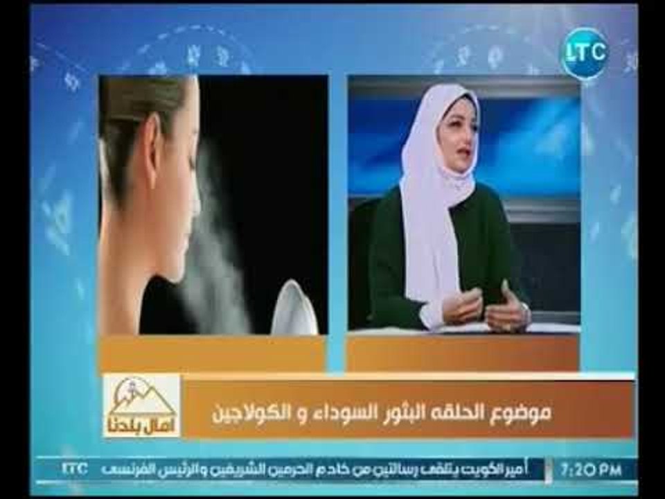 امال بلدنا | مع امال كمال و خبيرة التجميل حنان كمال حول البثور السوداء والكولاجين 4-12-2018