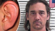 Dude bites chunk off man's ear after hot tub fight