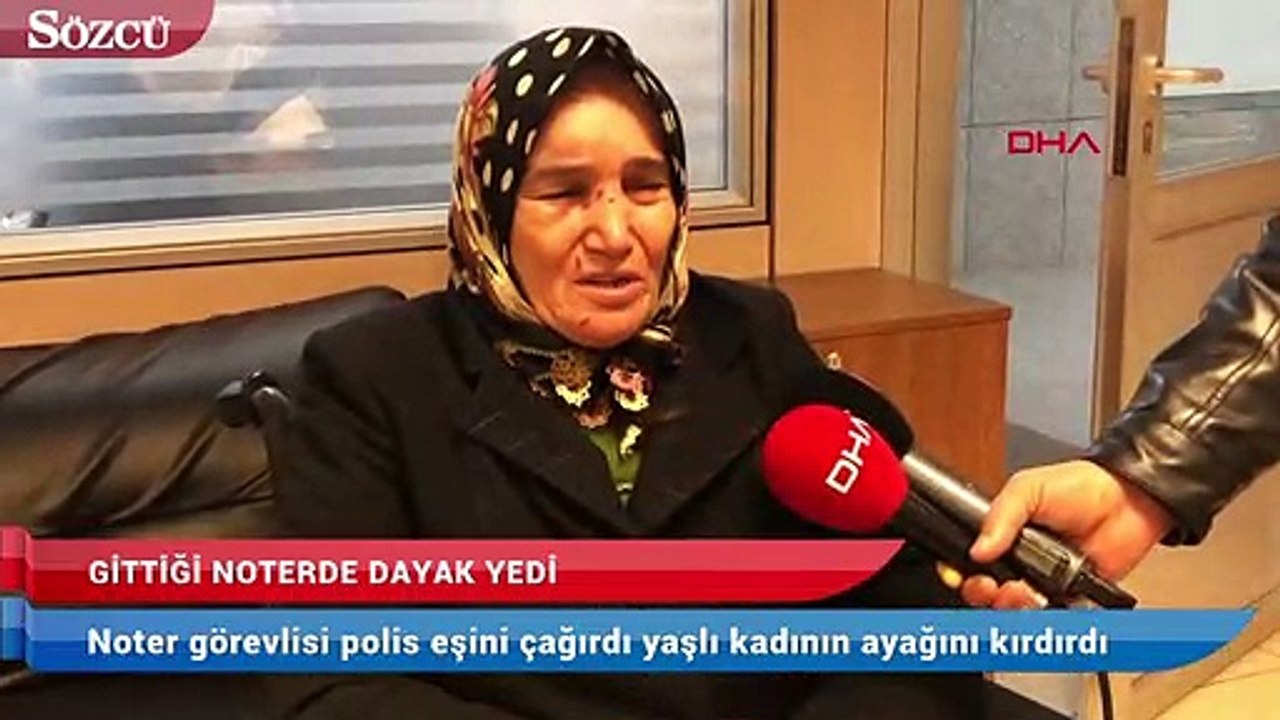 Noter görevlisi polis eşini çağırdı! 66 yaşındaki kadının ayağını kırdırdı