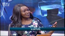Causes & Risk Factors Of Lupus