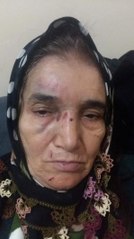 Vekalet İşlemleri İçin Gittiği Noterde Dayak Yedi