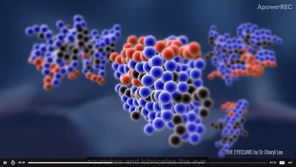 What cause dry eyes Pay a visit to eye doctor