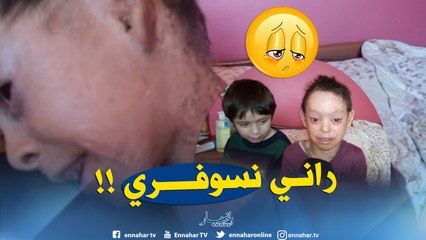 طفل بجلد سمكة يبكي بحرقة.. "لحمي يحرقني ويوجعني"