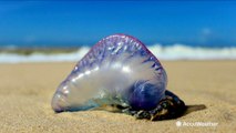 Thousands of beachgoers stung during jellyfish invasion