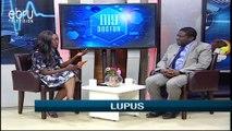 Lupus: Types, Treatment, Symptoms (Full Eps)