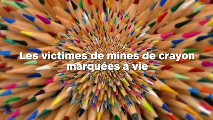 Incroyable, découvrez ces victimes de marque de mine de crayon sur la peau !
