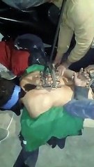 Presunto ladrón fue marcado en la espalda con un fierro caliente