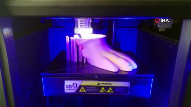 Kocabaş 3 boyutlu yazıcı ile yapılan protez bacakla yeniden yürüdü