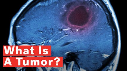What Is A Tumor?