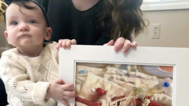 Premature Baby Defies Odds And Celebrates First Birthday