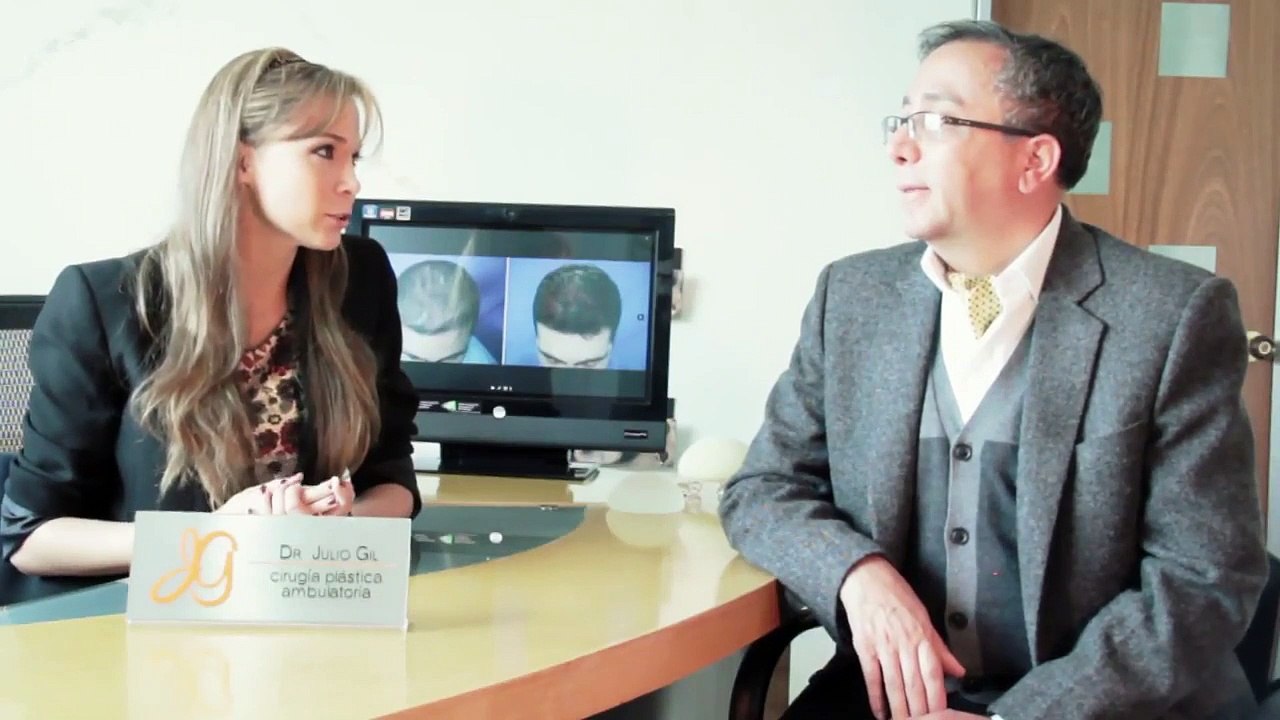 Mujeres con Alopecia - Testimonio de Implante Capilar en Bogotá