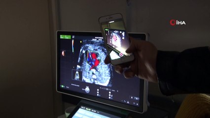 Anne adaylarına dört boyutlu ultrasonla perinatoloji hizmeti