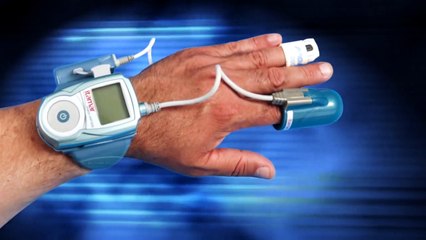 Complete Guide to the WatchPAT Sleep Study 💤