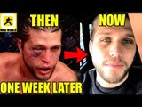 You won't believe the tranformation of Brian Ortega just days after UFC 231,Jon Jones,Askren