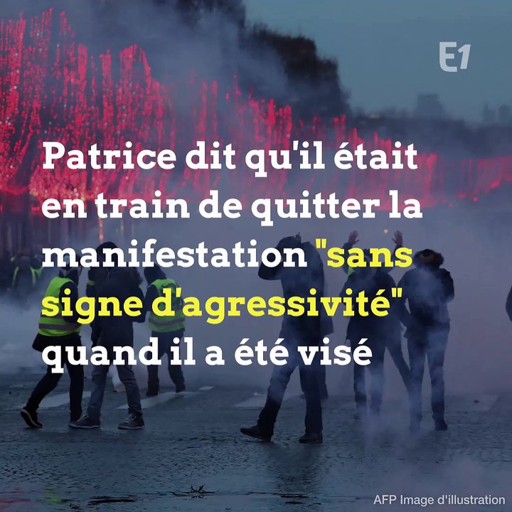 Patrice, "gilet jaune" blessé par un tir de lanceur de balles de défense