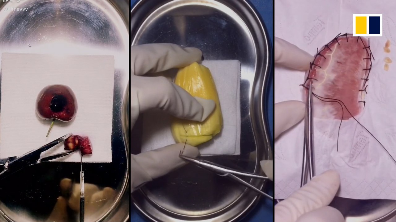 China’s ‘Fruit surgeon’