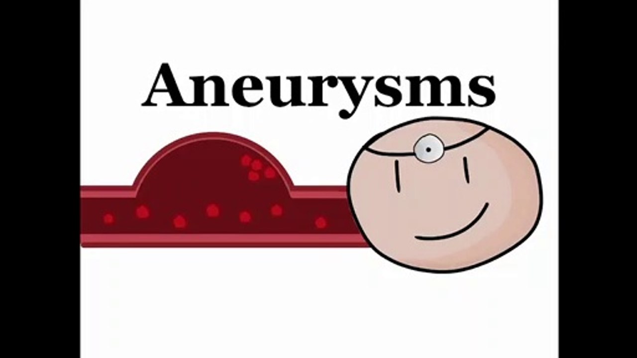 Disease Central- Aneurysms