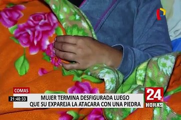 MIMP apoyará a mujer desfigurada con una piedra por su expareja