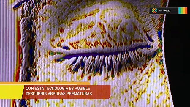 bd-tratamiento-diagnostico-profundo-condicion-piel-180119