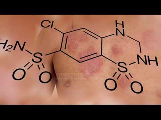 Ilaçi përgjegjës për tumore  - Top Channel Albania - News - Lajme