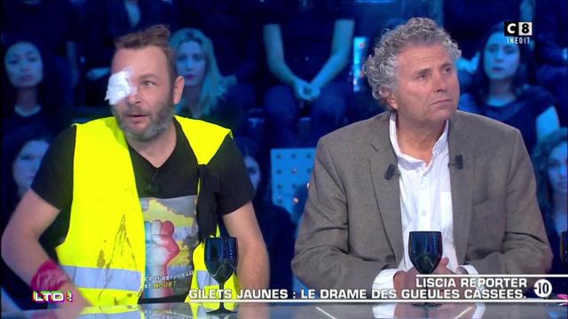 Un Gilet Jaune Qui A Perdu Un œil à Cause Dun Tir De Flashball Témoigne