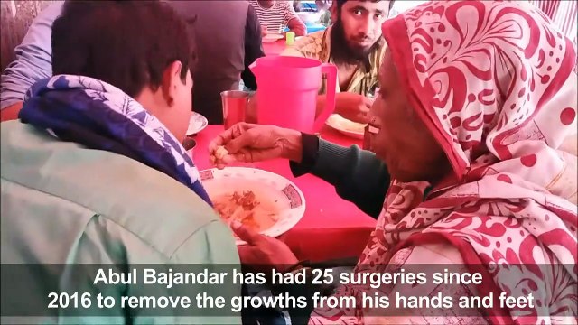 Bangladesh 'Tree Man' returns to hospital as condition worsens