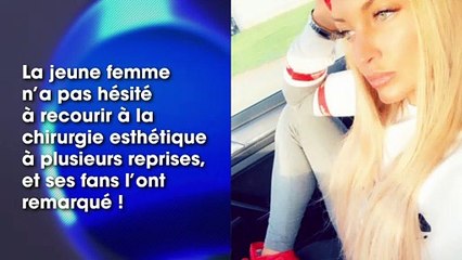 Aurélie Dotremont : méconnaissable après la chirurgie ? Un cliché étonne les internautes !