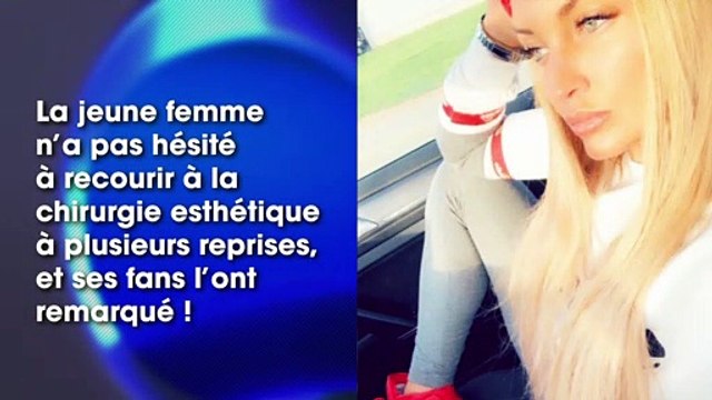 Aurélie Dotremont : méconnaissable après la chirurgie ? Un cliché étonne les internautes !