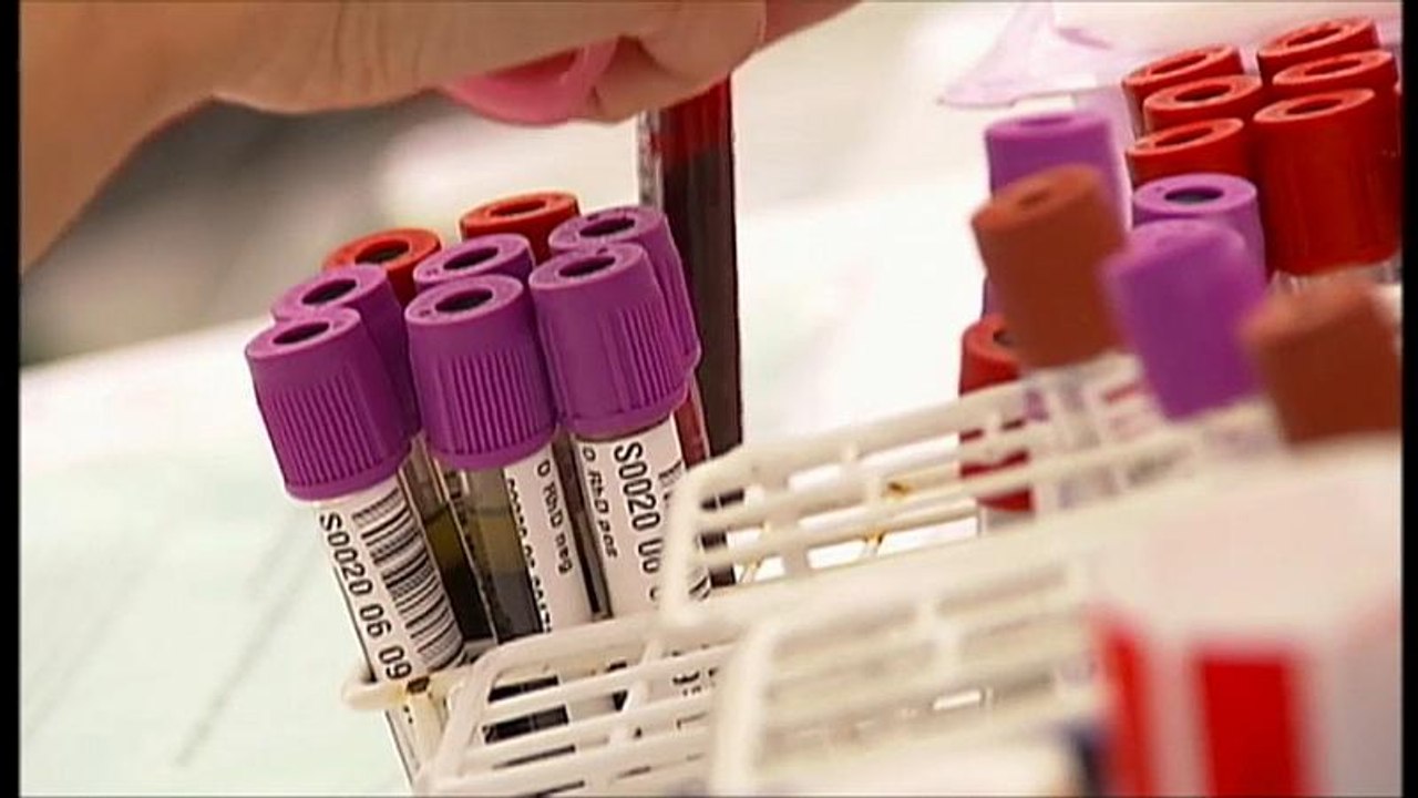 Bessere Früherkennung bei Prostatakrebs?