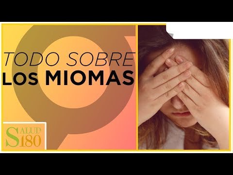 Beneficios de la embolización de miomas Parte III | Salud180