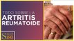 Artritis: Síntomas y tratamiento | Salud180
