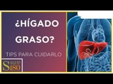 Exceso de grasa en el hígado | Salud180