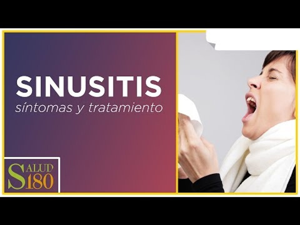 Sinusitis y sus principales características | Salud180