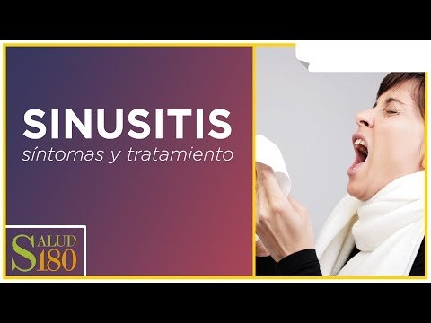 Sinusitis y sus principales características | Salud180