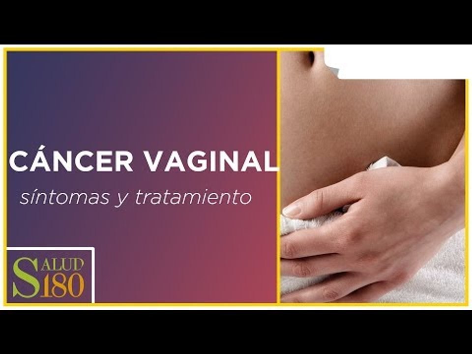Cáncer vaginal: síntomas y tratamiento | Salud180