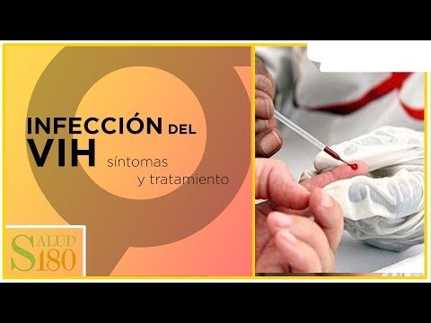 Infección por VIH: síntomas y características | Salud180
