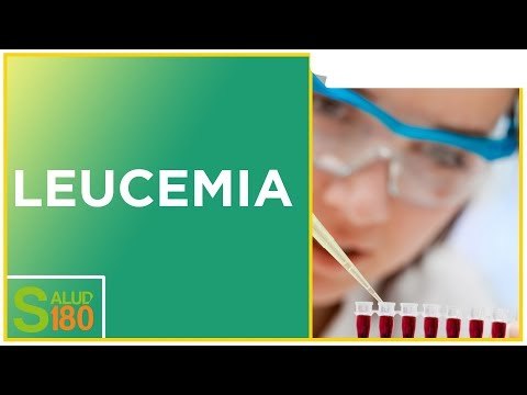 Características de la leucemia aguda | Salud180