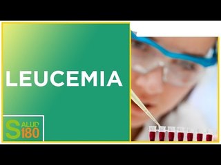 Tratamiento de la leucemia aguda | Salud180