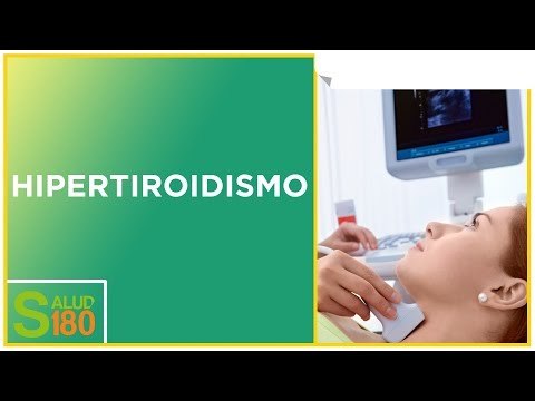 Características del hipertiroidismo | Salud180