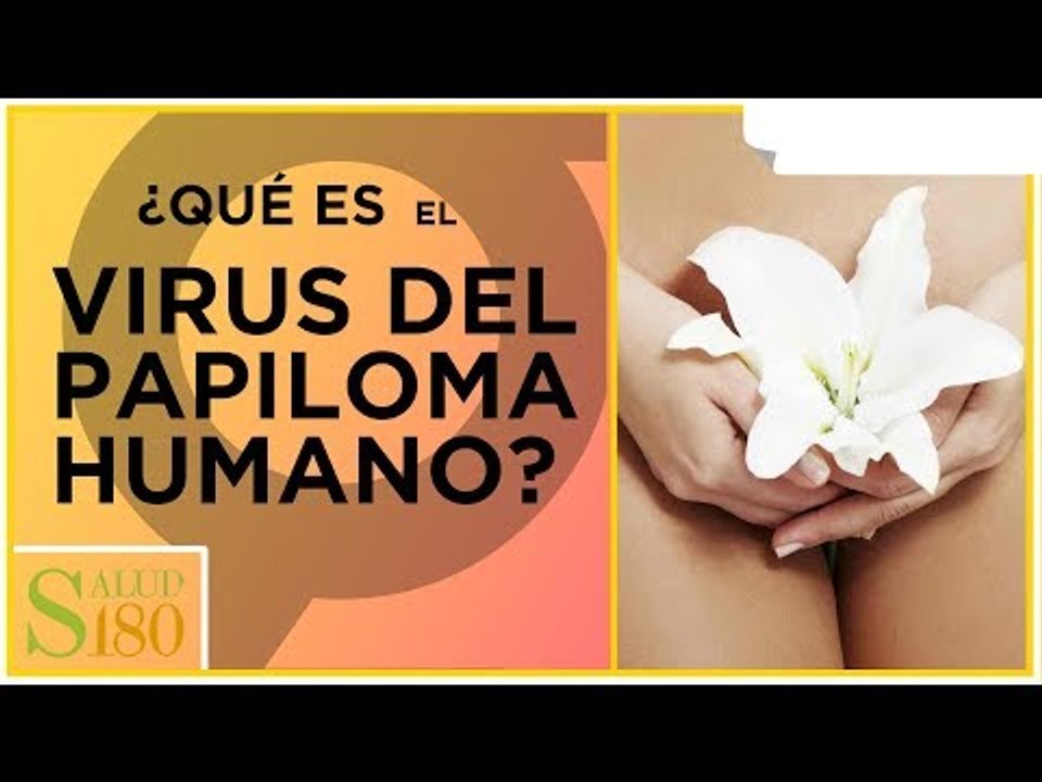 Diagnóstico del virus del papiloma humano (VPH) | Salud180