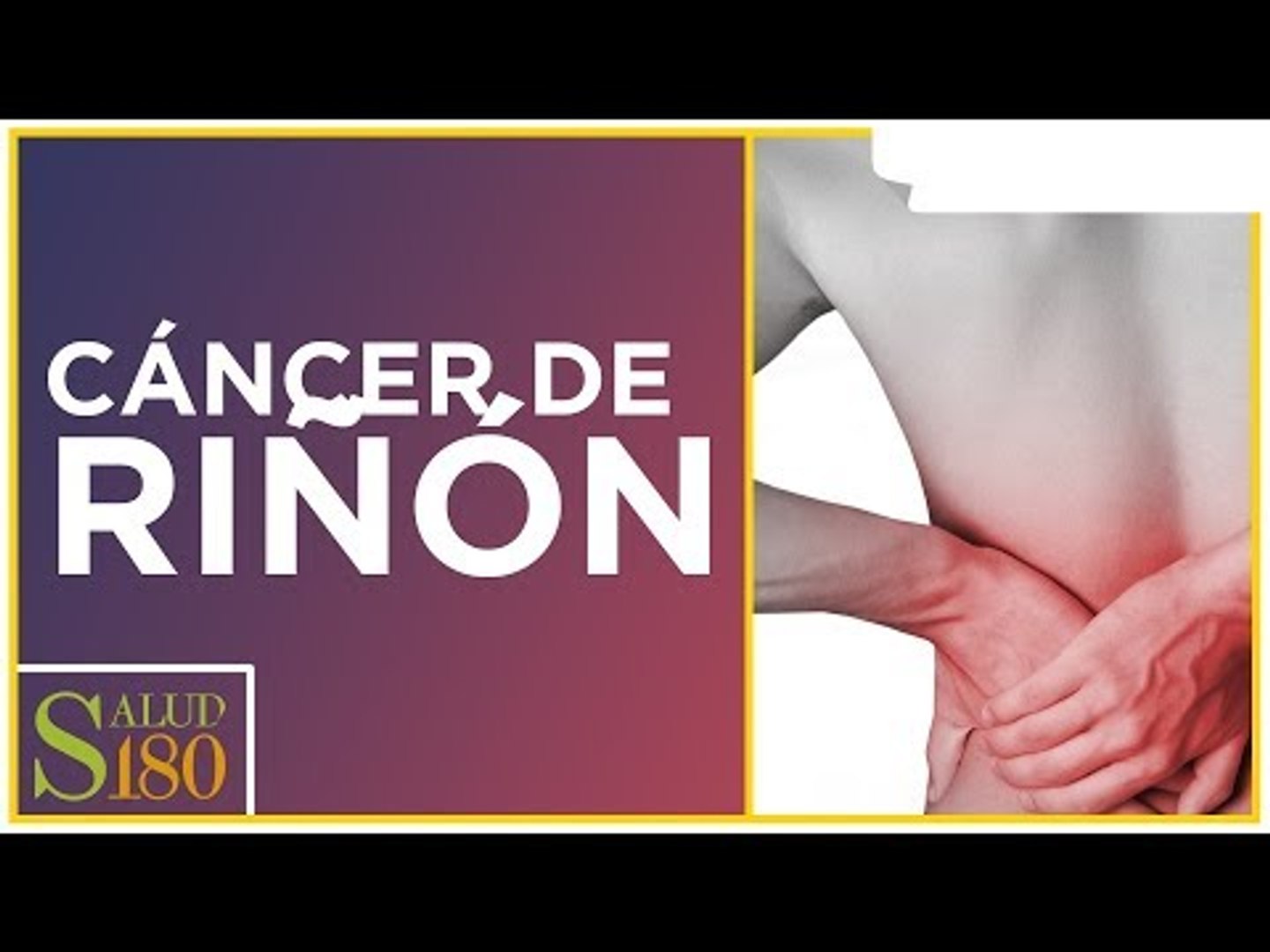 ⁣Cáncer renal, características y diagnóstico | Salud180