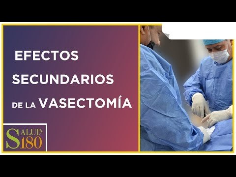 Efectos secundarios de las vasectomía | Salud180