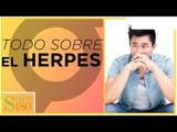 Herpes: síntomas y tratamiento | Salud180