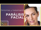Síntomas de parálisis facial | Salud180