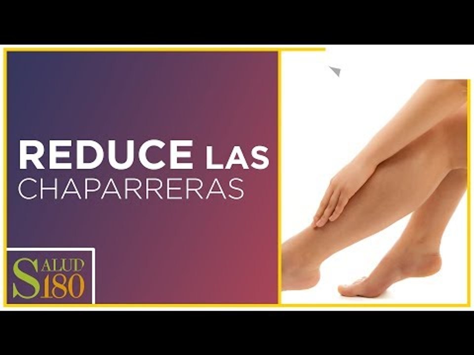 Reduce tus chaparreras con estos ejercicios | Salud180
