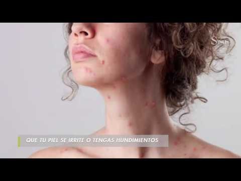 Síntomas “menos conocidos” del cáncer de mama | Salud180 WB