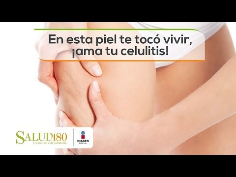En esta piel te tocó vivir, ¡ama tu celulitis! | Salud180