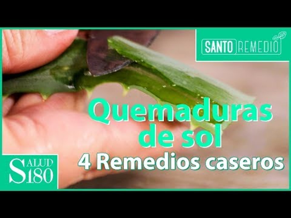 Los mejores remedios para las quemaduras de sol | Salud180