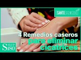 Cómo quitar las cicatrices en la piel remedios efectivos