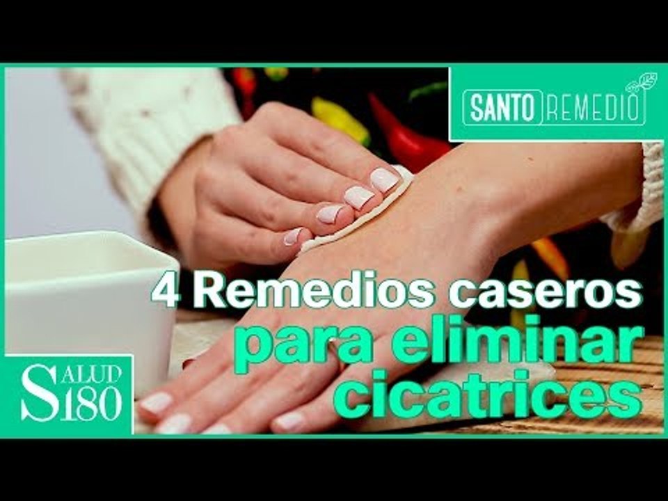 Cómo quitar las cicatrices en la piel remedios efectivos